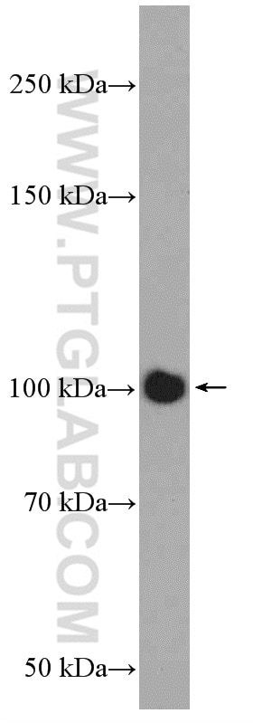 Western Blot (WB) analysis of mouse brain tissue using DAAM2 Polyclonal antibody (25206-1-AP)