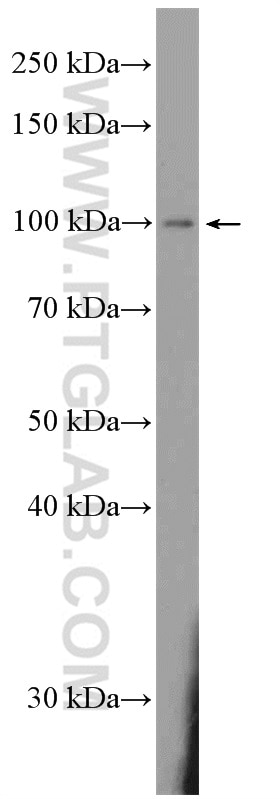 Western Blot (WB) analysis of rat brain tissue using DAAM2 Polyclonal antibody (25206-1-AP)