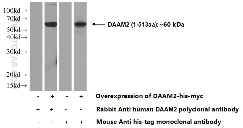 Western Blot (WB) analysis of Transfected HEK-293 cells using DAAM2 Polyclonal antibody (25206-1-AP)