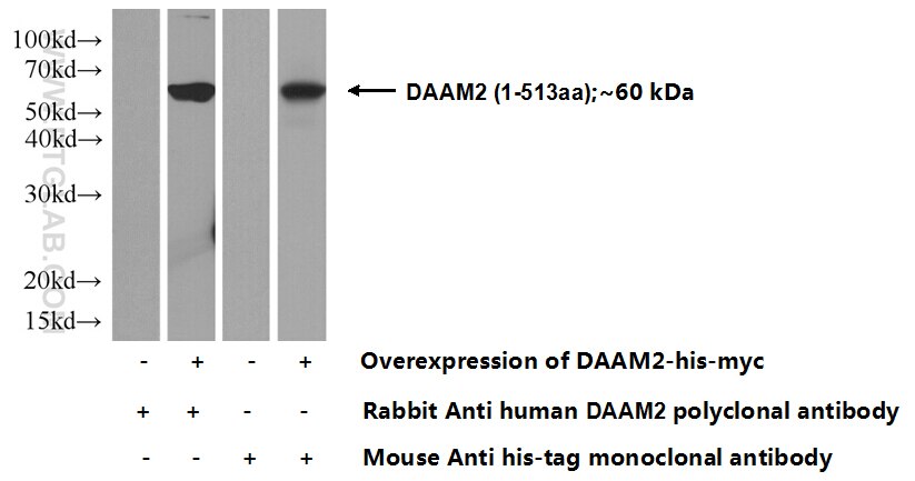 Western Blot (WB) analysis of Transfected HEK-293 cells using DAAM2 Polyclonal antibody (25206-1-AP)