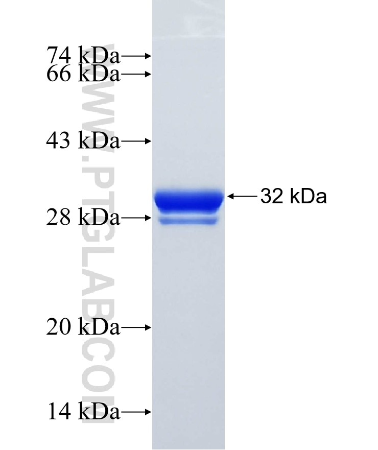 DAAM2 fusion protein Ag18955 SDS-PAGE