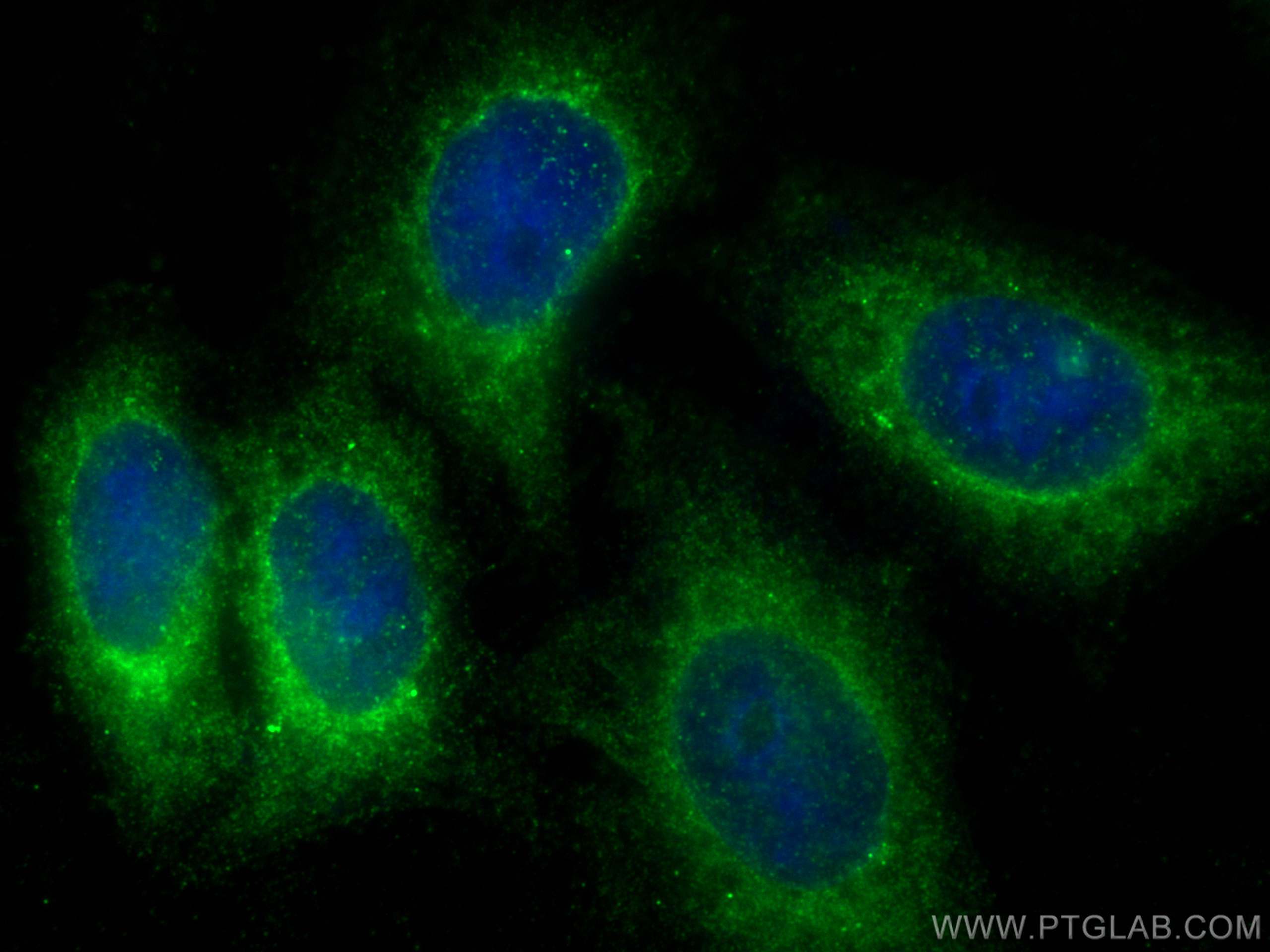 Immunofluorescence (IF) / fluorescent staining of HepG2 cells using DAB1 Polyclonal antibody (31459-1-AP)