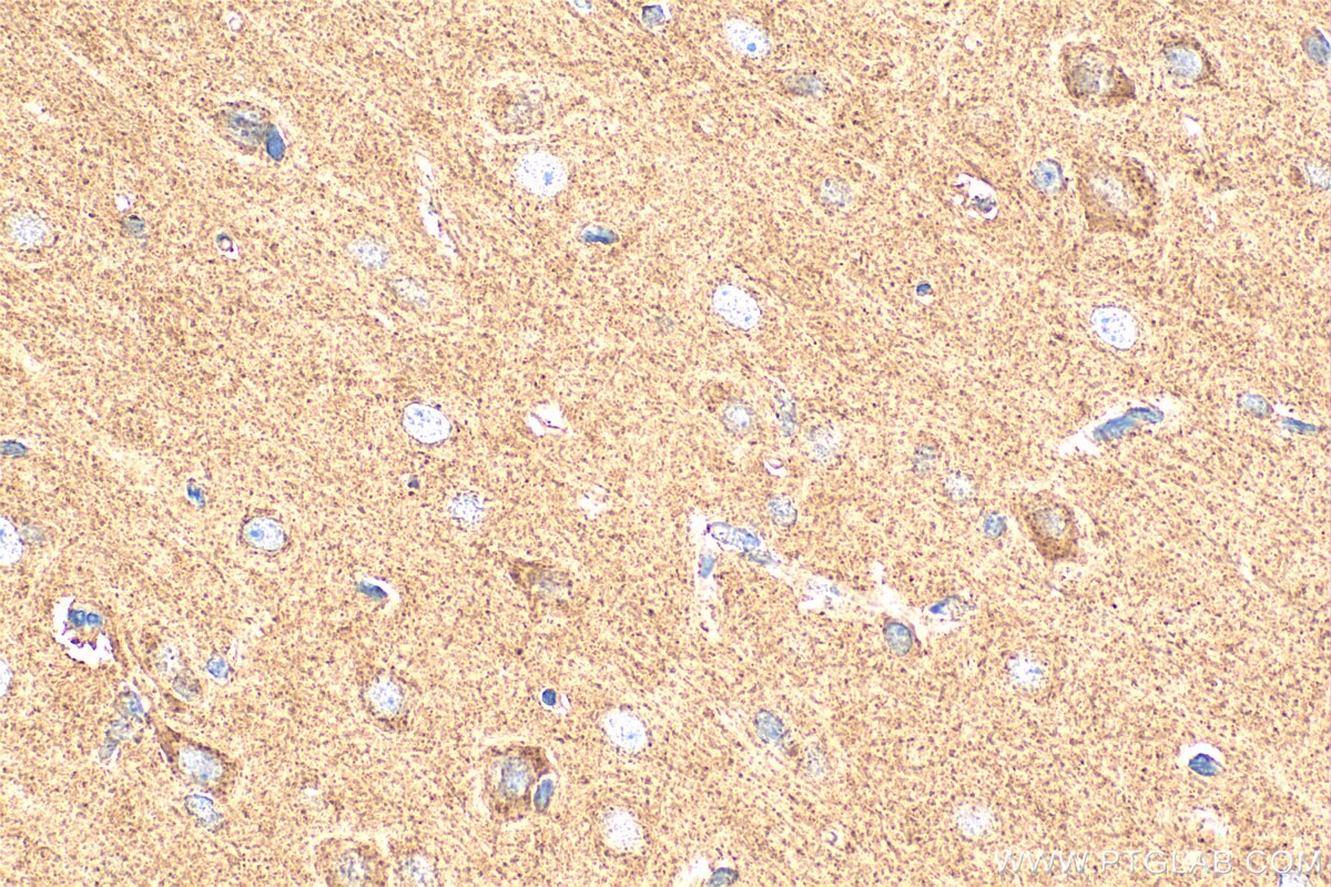 Immunohistochemistry (IHC) staining of rat brain tissue using DAB1 Polyclonal antibody (31459-1-AP)