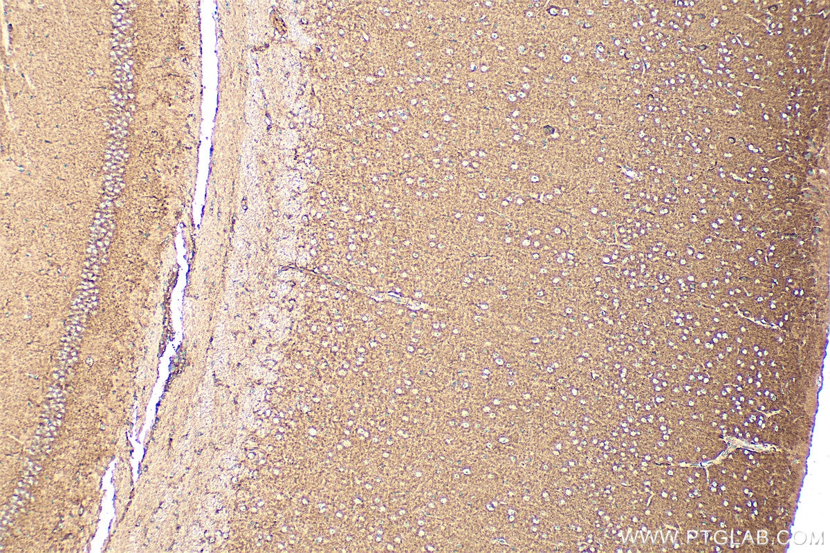 Immunohistochemistry (IHC) staining of mouse brain tissue using DAB1 Polyclonal antibody (31459-1-AP)