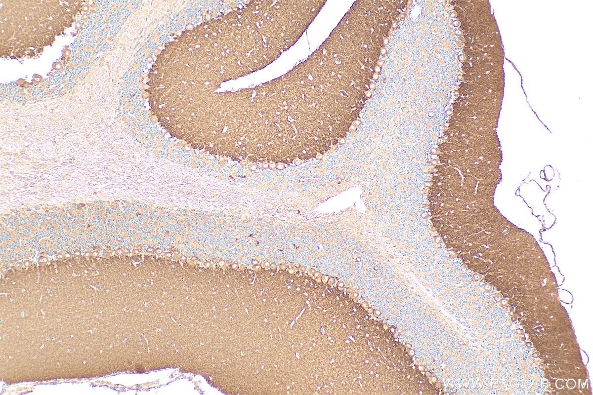 Immunohistochemistry (IHC) staining of mouse cerebellum tissue using DAB1 Polyclonal antibody (31459-1-AP)