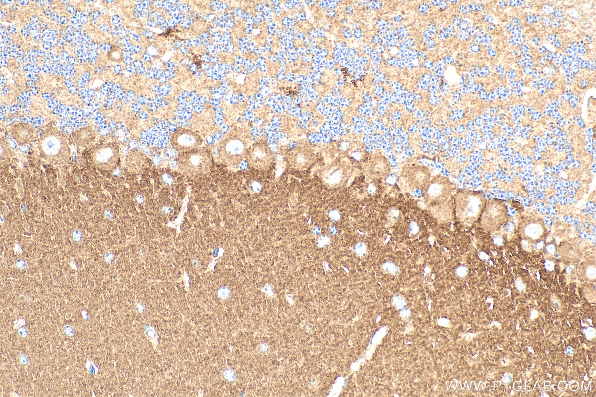 Immunohistochemistry (IHC) staining of mouse cerebellum tissue using DAB1 Polyclonal antibody (31459-1-AP)