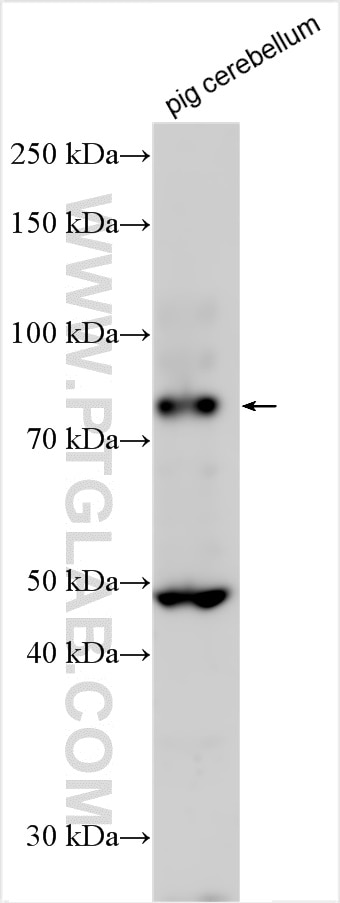 Western Blot (WB) analysis of various lysates using DAB1 Polyclonal antibody (31459-1-AP)