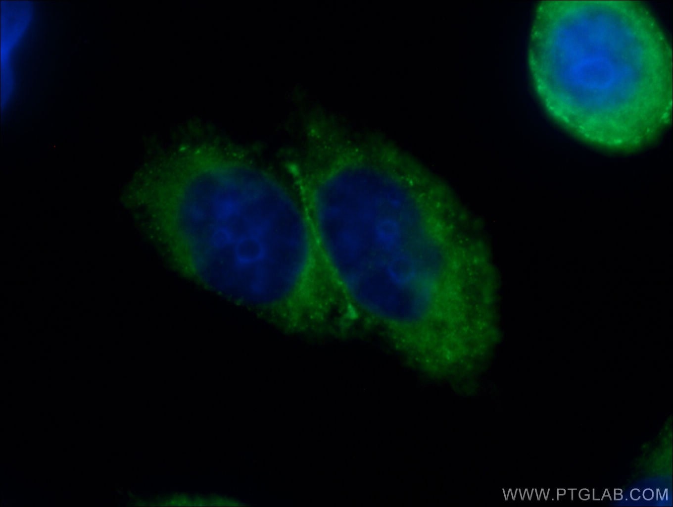 Immunofluorescence (IF) / fluorescent staining of HeLa cells using DAB2 Polyclonal antibody (10109-2-AP)