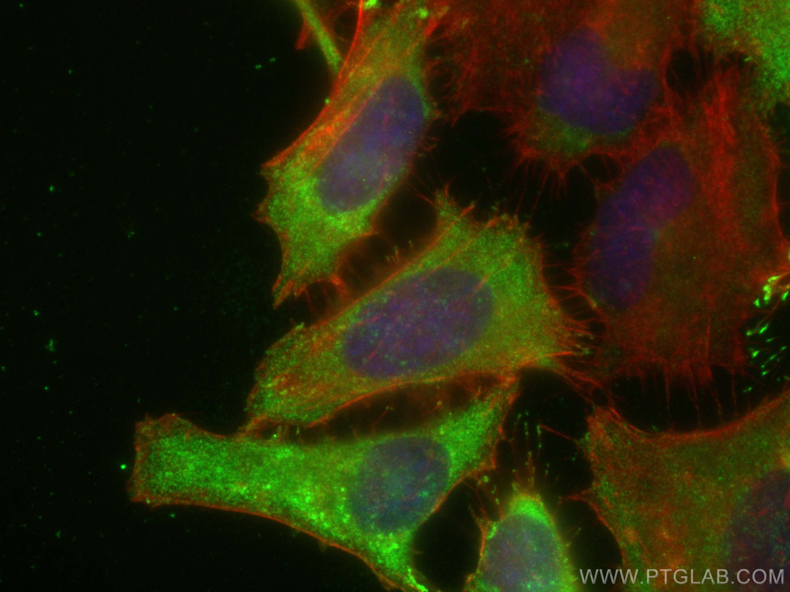 Immunofluorescence (IF) / fluorescent staining of HeLa cells using DAB2 Polyclonal antibody (10109-2-AP)