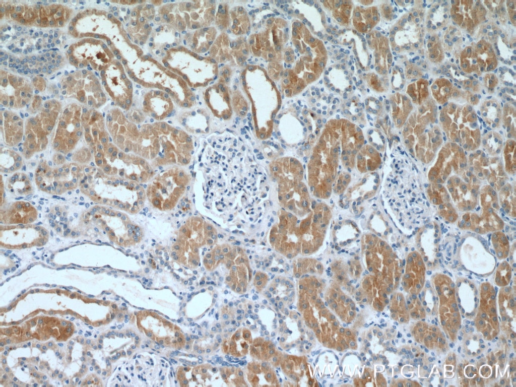 Immunohistochemistry (IHC) staining of human kidney tissue using DAB2 Polyclonal antibody (10109-2-AP)