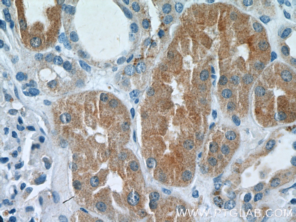 Immunohistochemistry (IHC) staining of human kidney tissue using DAB2 Polyclonal antibody (10109-2-AP)