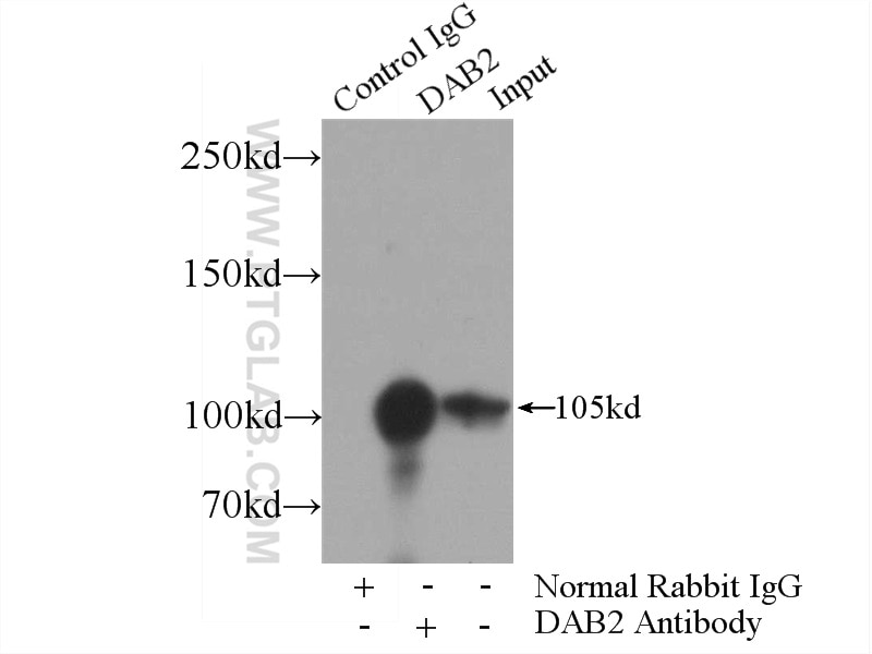 Immunoprecipitation (IP) experiment of HeLa cells using DAB2 Polyclonal antibody (10109-2-AP)