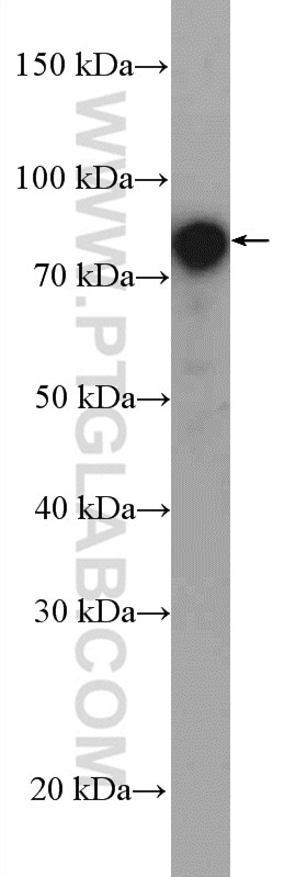 Western Blot (WB) analysis of HeLa cells using DAB2 Polyclonal antibody (10109-2-AP)