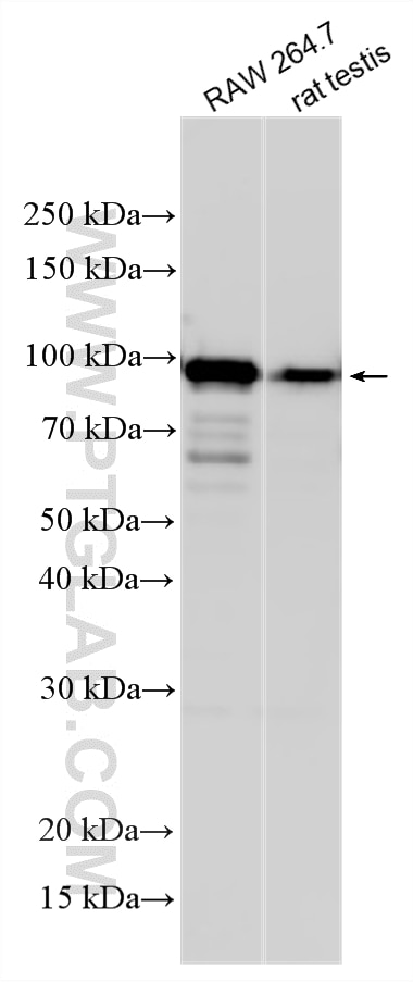 Western Blot (WB) analysis of various lysates using DAB2 Polyclonal antibody (10109-2-AP)