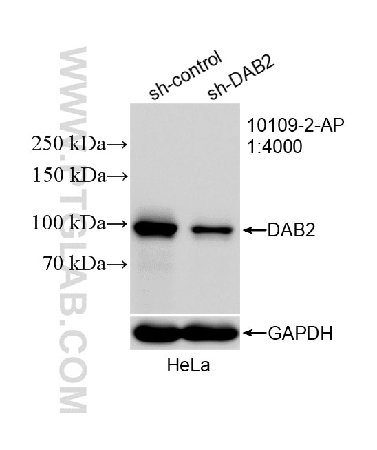 WB analysis of HeLa using 10109-2-AP Western Blot (WB) analysis of HeLa cells using DAB2 Polyclonal antibody (10109-2-AP)