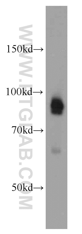 Western Blot (WB) analysis of HeLa cells using DAB2 Polyclonal antibody (10109-2-AP)