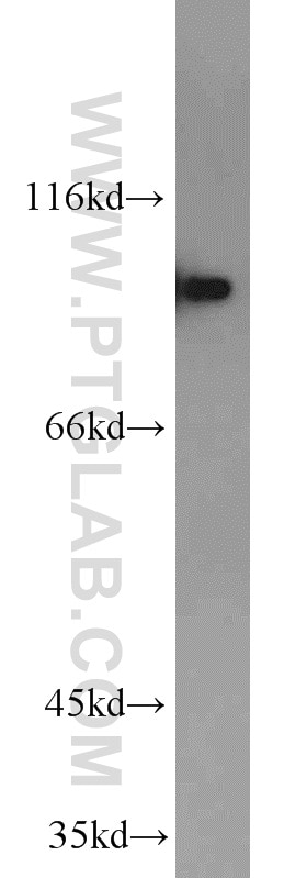 Western Blot (WB) analysis of MCF-7 cells using DAB2 Polyclonal antibody (10109-2-AP)