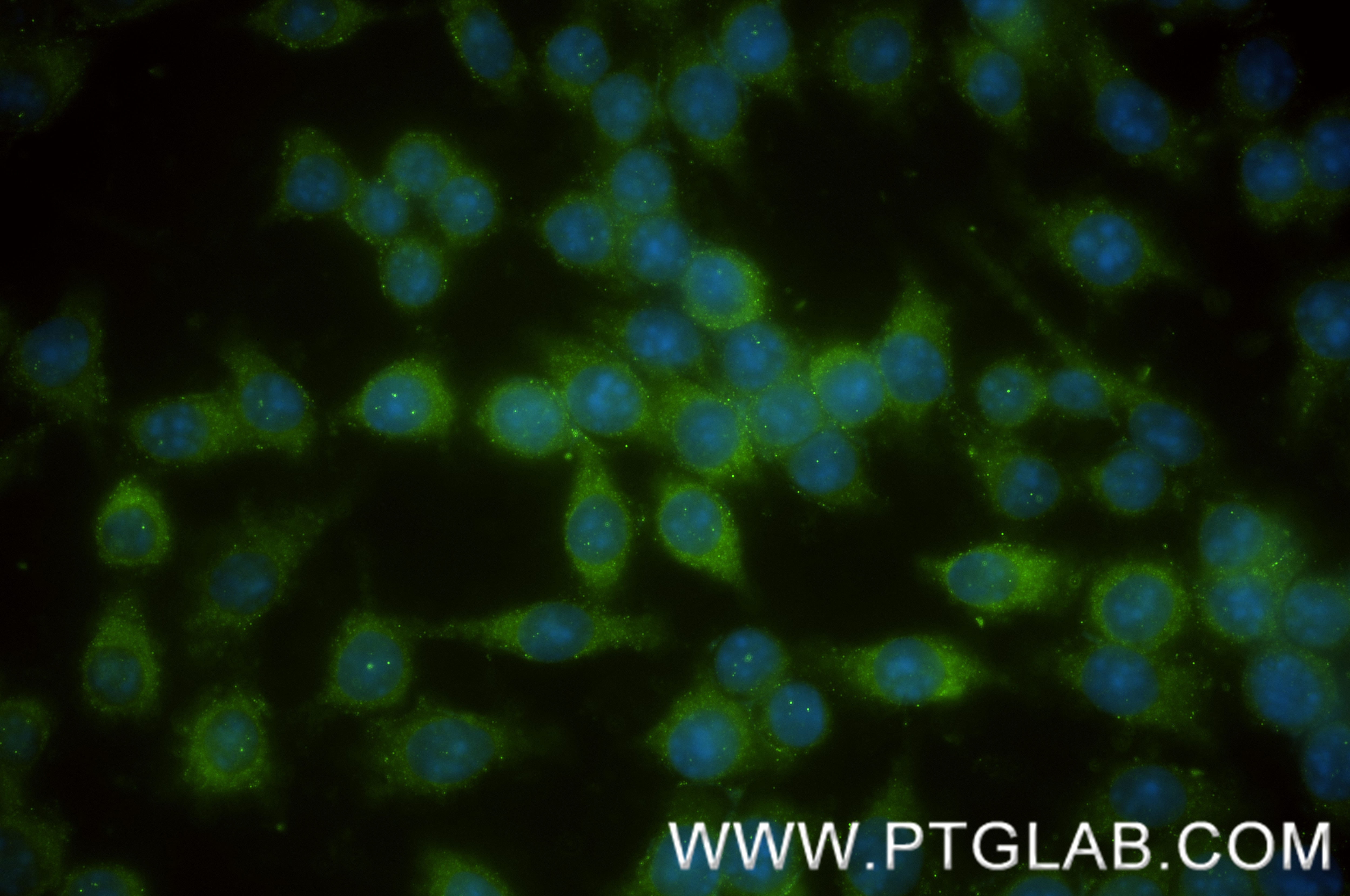 Immunofluorescence (IF) / fluorescent staining of RAW 264.7 cells using DAB2 Recombinant antibody (86141-1-RR)