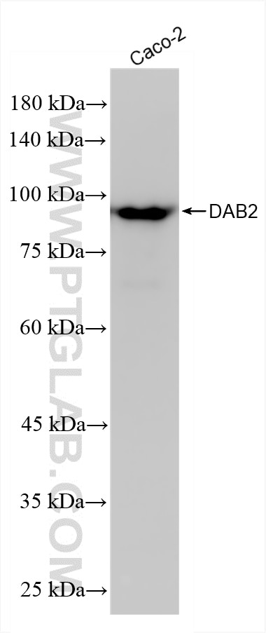 DAB2