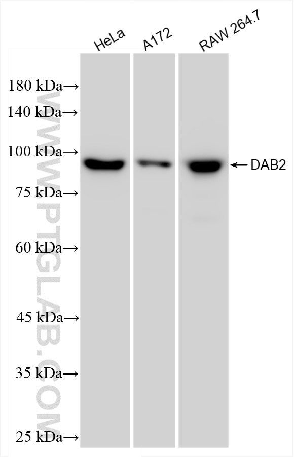 Western Blot (WB) analysis of various lysates using DAB2 Recombinant antibody (86141-1-RR)