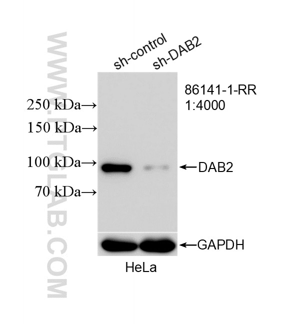 WB analysis of HeLa using 86141-1-RR Western Blot (WB) analysis of HeLa cells using DAB2 Recombinant monoclonal antibody (86141-1-RR)