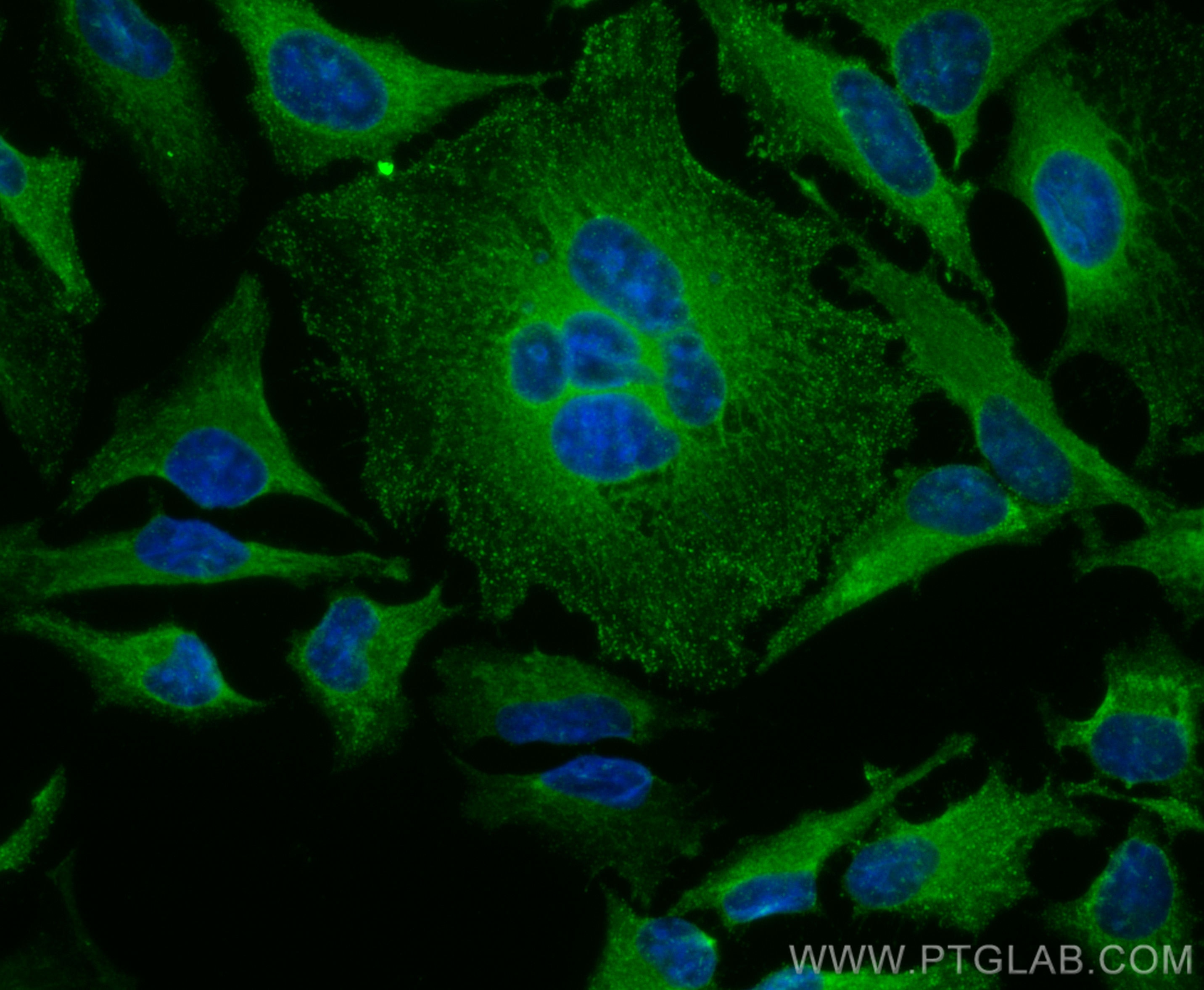 Immunofluorescence (IF) / fluorescent staining of HeLa cells using CoraLite® Plus 488-conjugated DAB2 Polyclonal anti (CL488-10109)