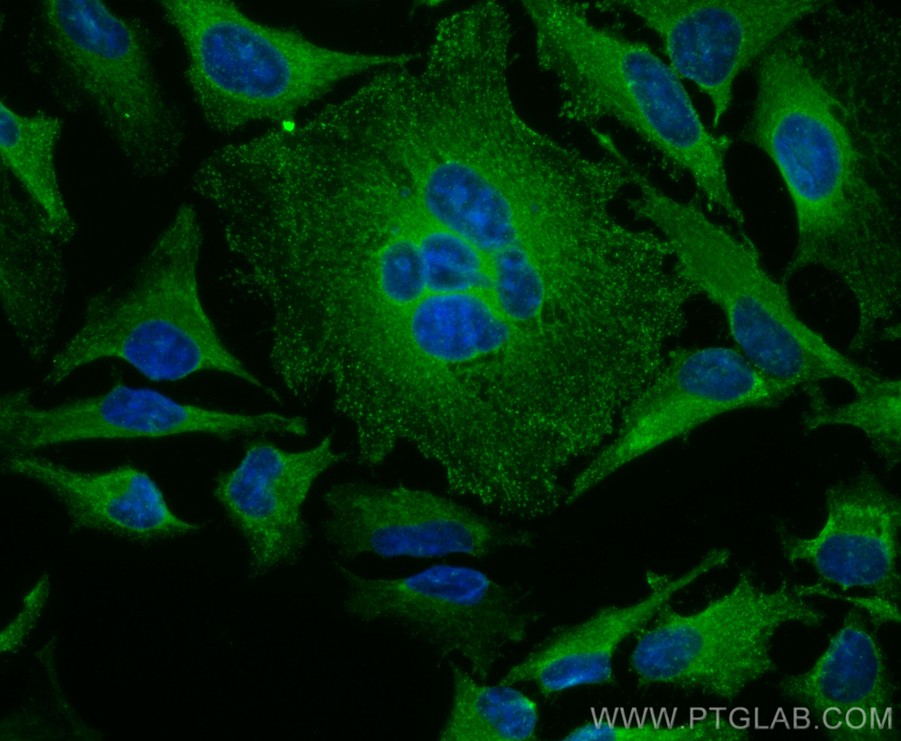 IF Staining of HeLa using CL488-10109