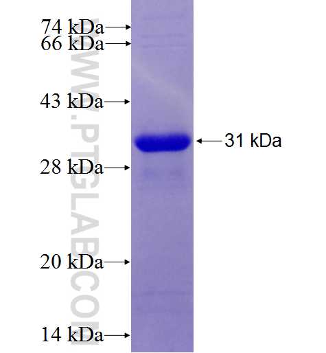 DAB2 fusion protein Ag27192 SDS-PAGE