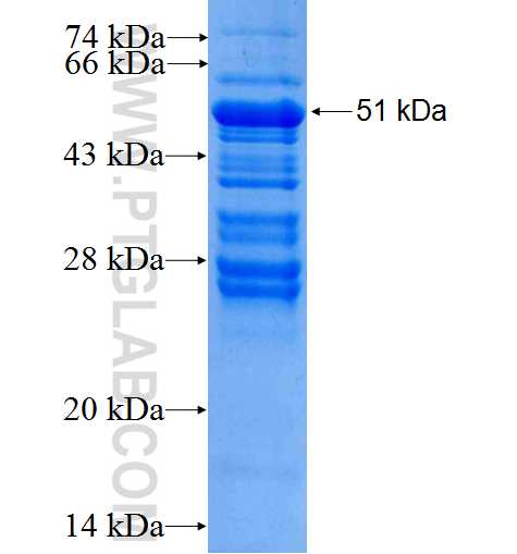DAB2 fusion protein Ag0162 SDS-PAGE