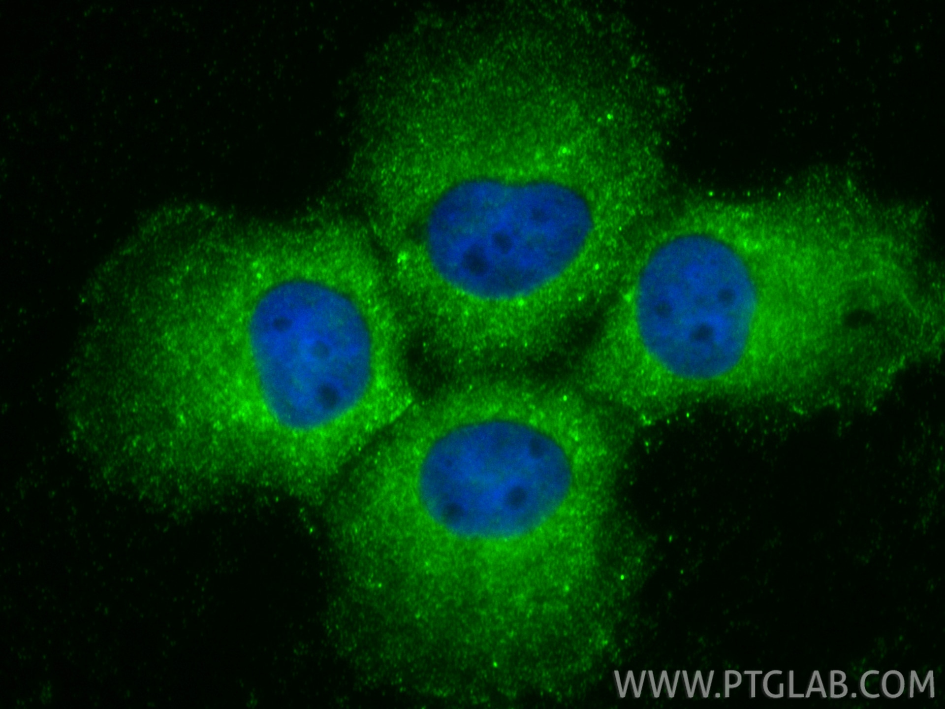 Immunofluorescence (IF) / fluorescent staining of A431 cells using DAB2IP Polyclonal antibody (23582-1-AP)