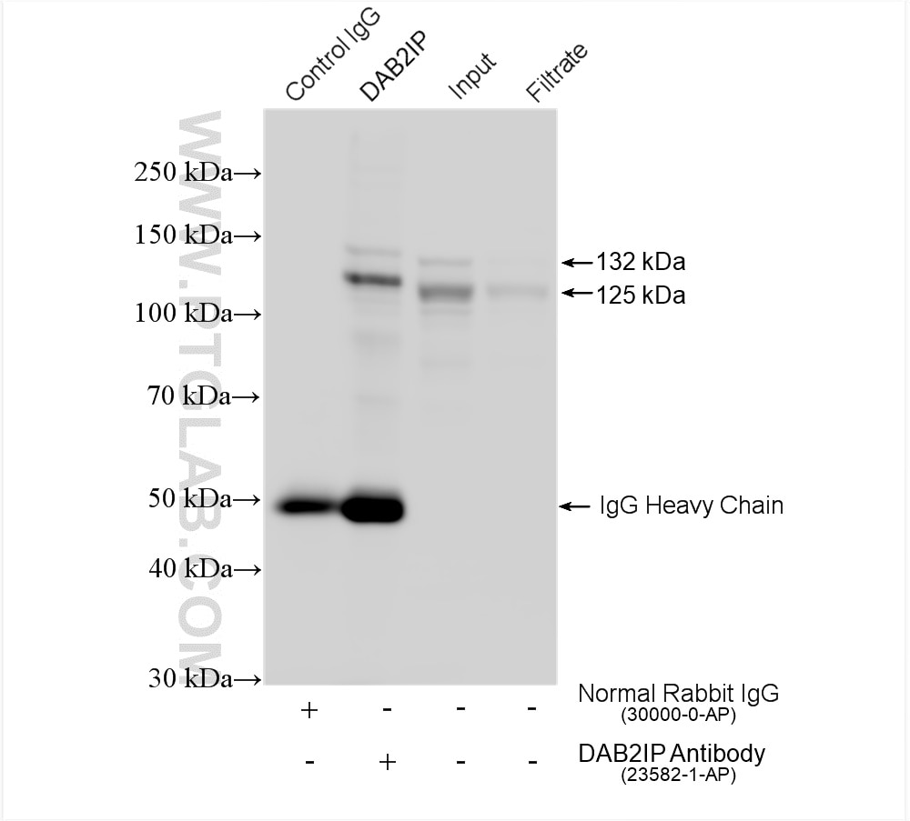 Immunoprecipitation (IP) experiment of mouse brain tissue using DAB2IP Polyclonal antibody (23582-1-AP)