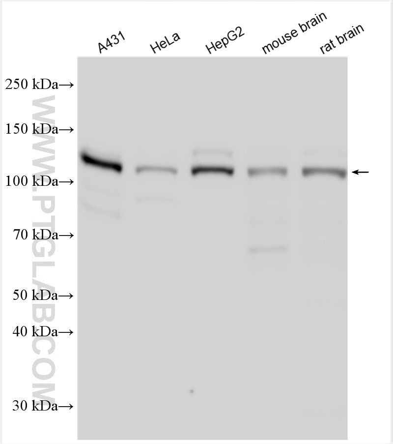 Western Blot (WB) analysis of various lysates using DAB2IP Polyclonal antibody (23582-1-AP)