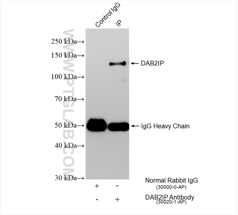 Immunoprecipitation (IP) experiment of 4T1 cells using DAB2IP Polyclonal antibody (30020-1-AP)