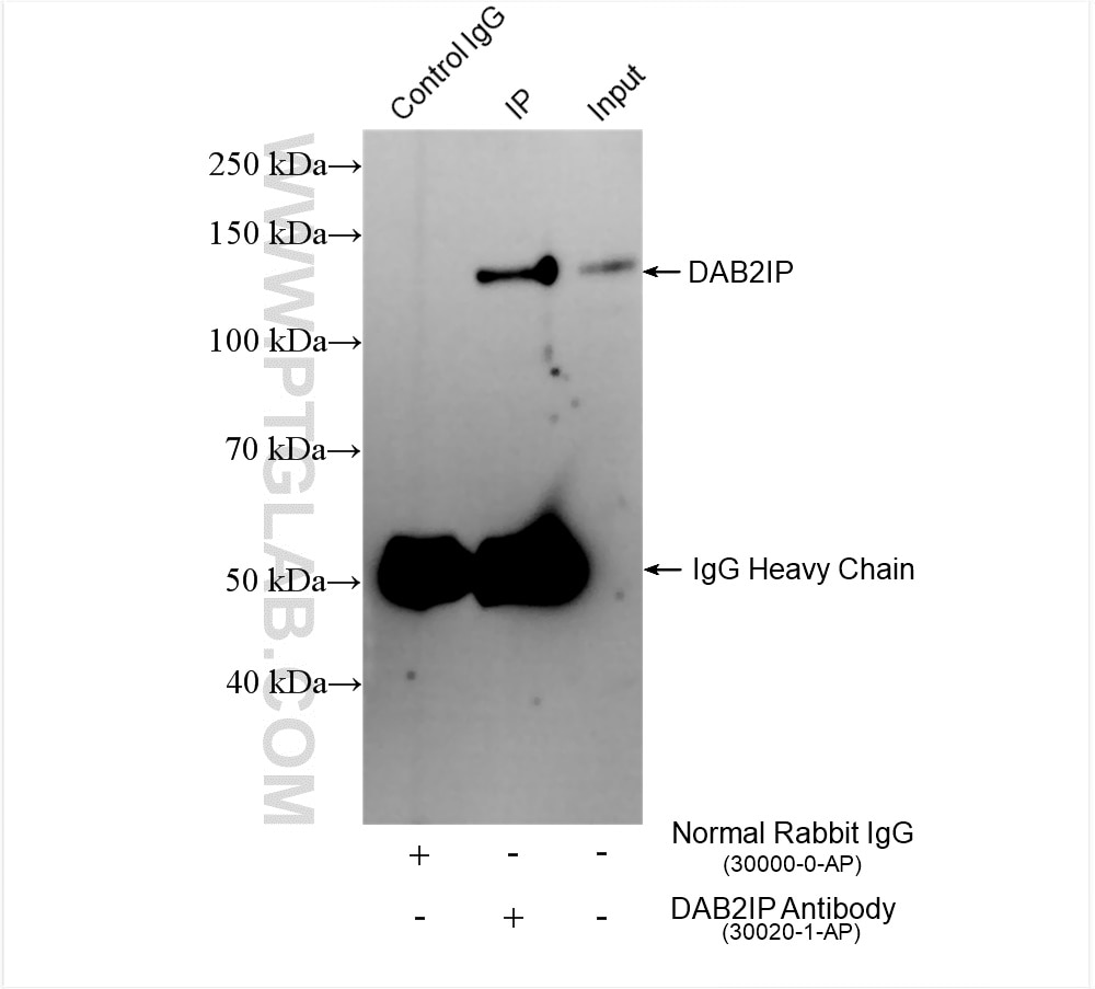 Immunoprecipitation (IP) experiment of 4T1 cells using DAB2IP Polyclonal antibody (30020-1-AP)