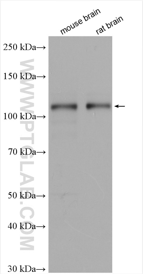 Western Blot (WB) analysis of various lysates using DAB2IP Polyclonal antibody (30020-1-AP)