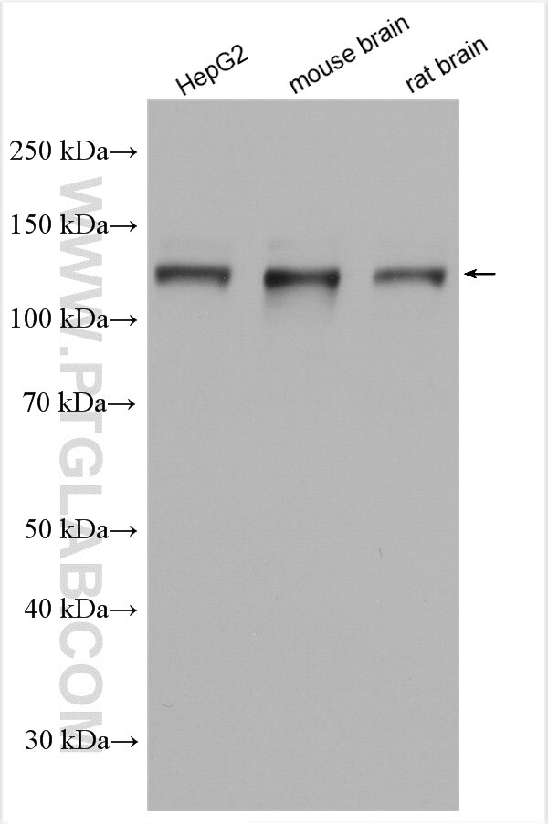 Western Blot (WB) analysis of various lysates using DAB2IP Polyclonal antibody (30020-1-AP)