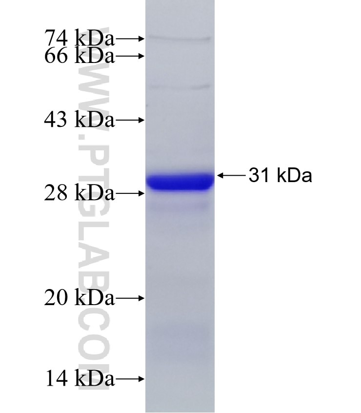 DAB2IP fusion protein Ag31354 SDS-PAGE