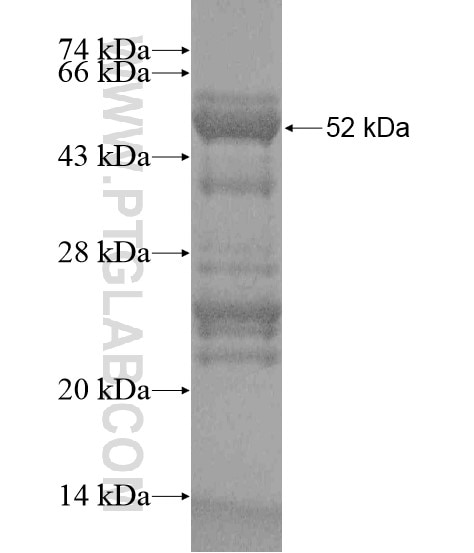 DAB2IP fusion protein Ag20308 SDS-PAGE