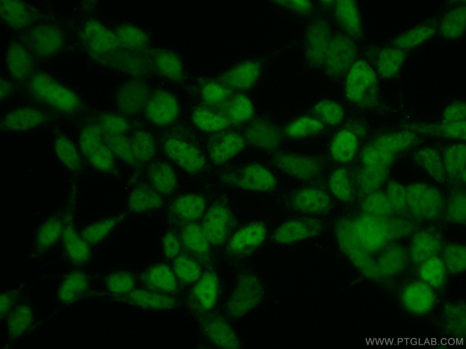 Immunofluorescence (IF) / fluorescent staining of HEK-293 cells using DACH1 Polyclonal antibody (10914-1-AP)