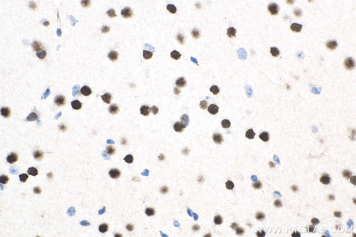 Immunohistochemistry (IHC) staining of mouse brain tissue using DACH1 Polyclonal antibody (10914-1-AP)