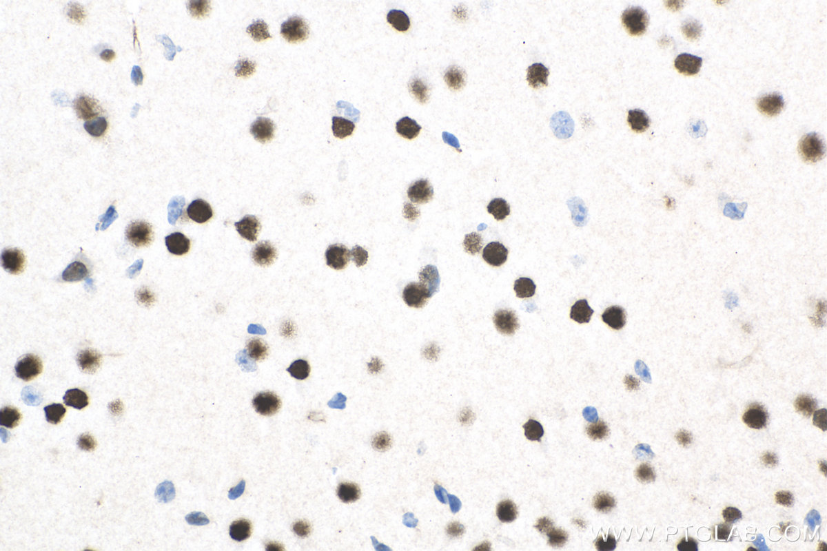 IHC staining of mouse brain using 10914-1-AP