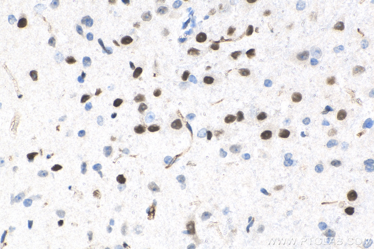 Immunohistochemistry (IHC) staining of mouse brain tissue using DACH1 Polyclonal antibody (10914-1-AP)