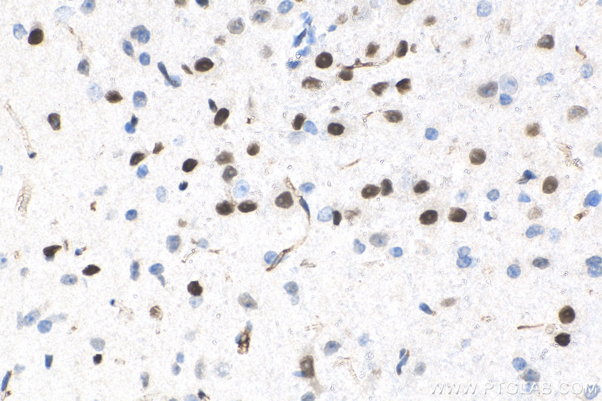 IHC staining of mouse brain using 10914-1-AP