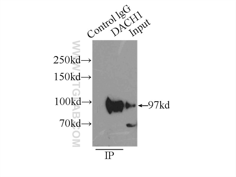 Immunoprecipitation (IP) experiment of HEK-293 cells using DACH1 Polyclonal antibody (10914-1-AP)