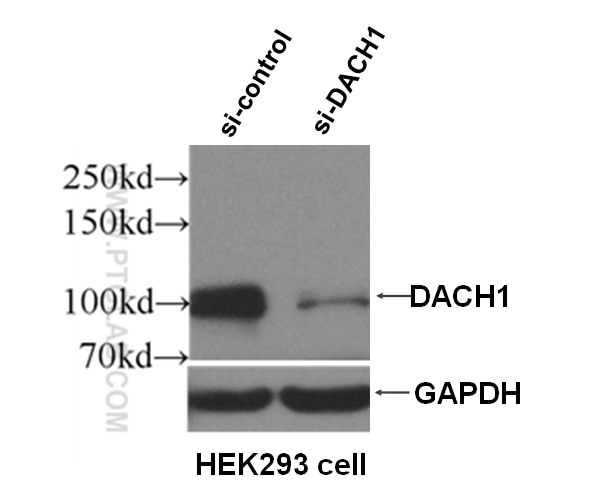 Western Blot (WB) analysis of HEK-293 cells using DACH1 Polyclonal antibody (10914-1-AP)