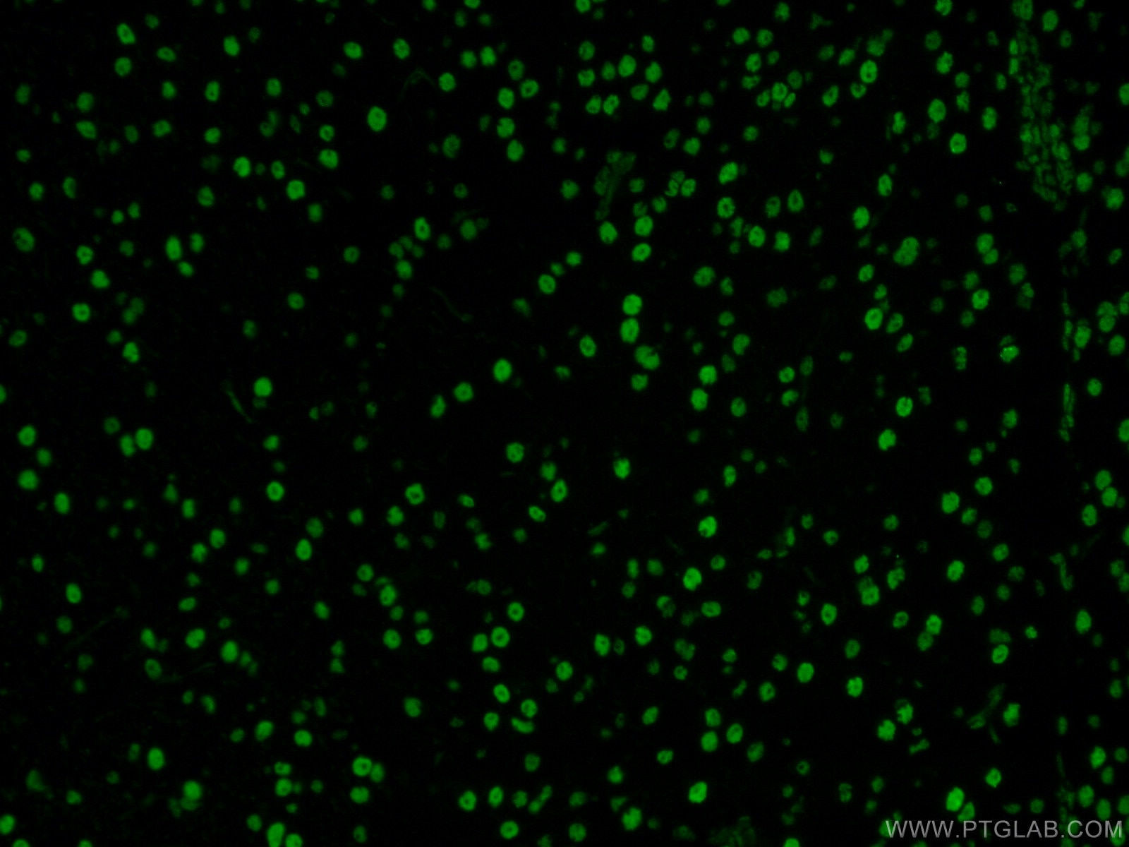 Immunofluorescence (IF) / fluorescent staining of mouse brain tissue using DACH1 Monoclonal antibody (60082-1-Ig)