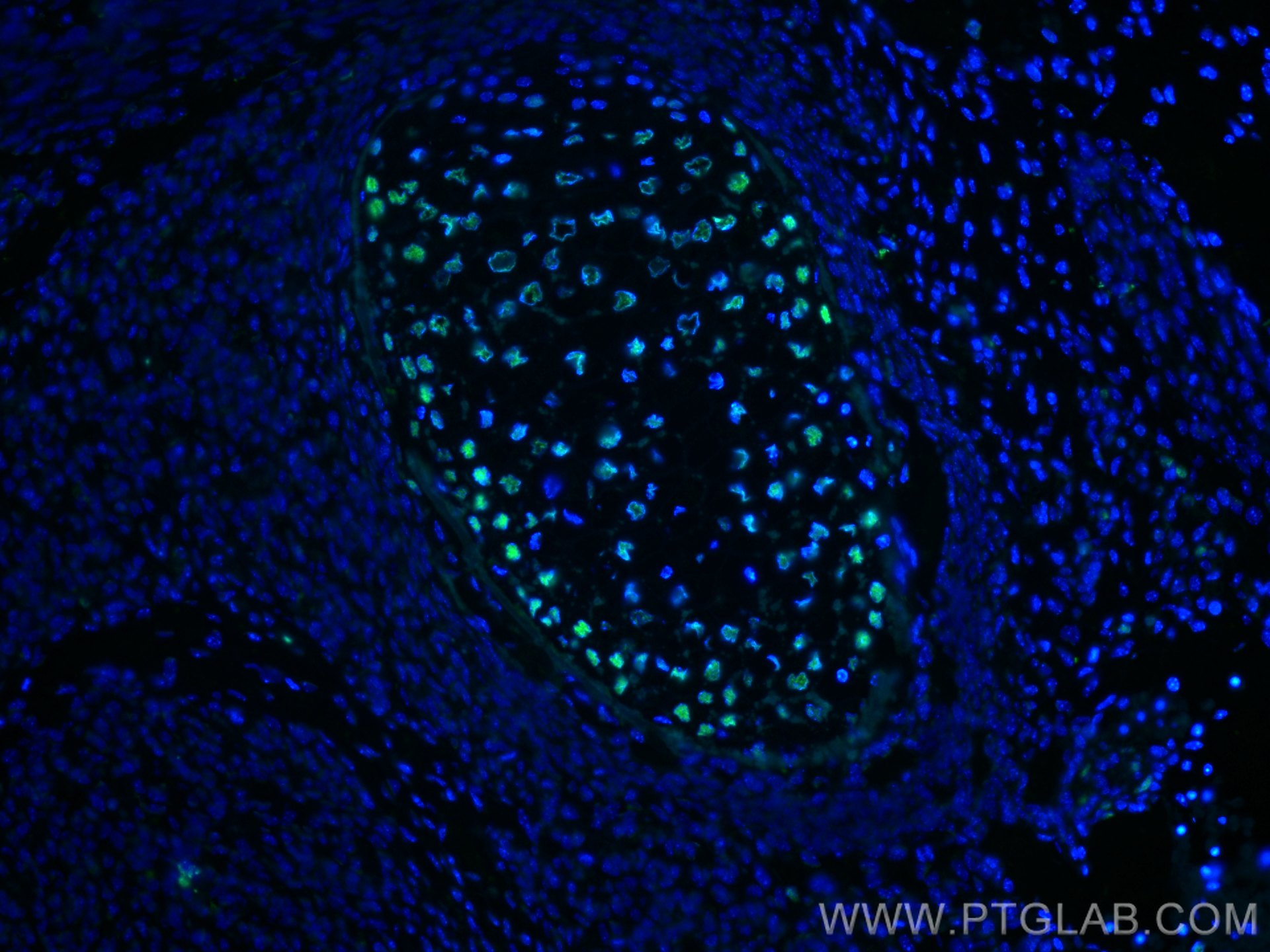 Immunofluorescence (IF) / fluorescent staining of mouse embryo tissue using DACH1 Monoclonal antibody (60082-1-Ig)