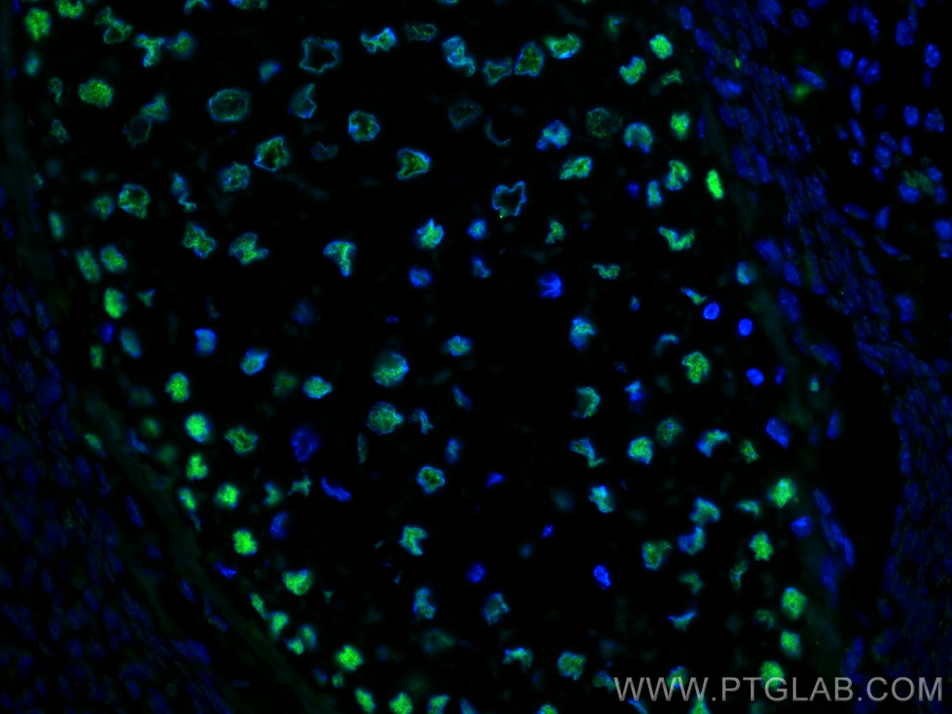 Immunofluorescence (IF) / fluorescent staining of mouse embryo tissue using DACH1 Monoclonal antibody (60082-1-Ig)