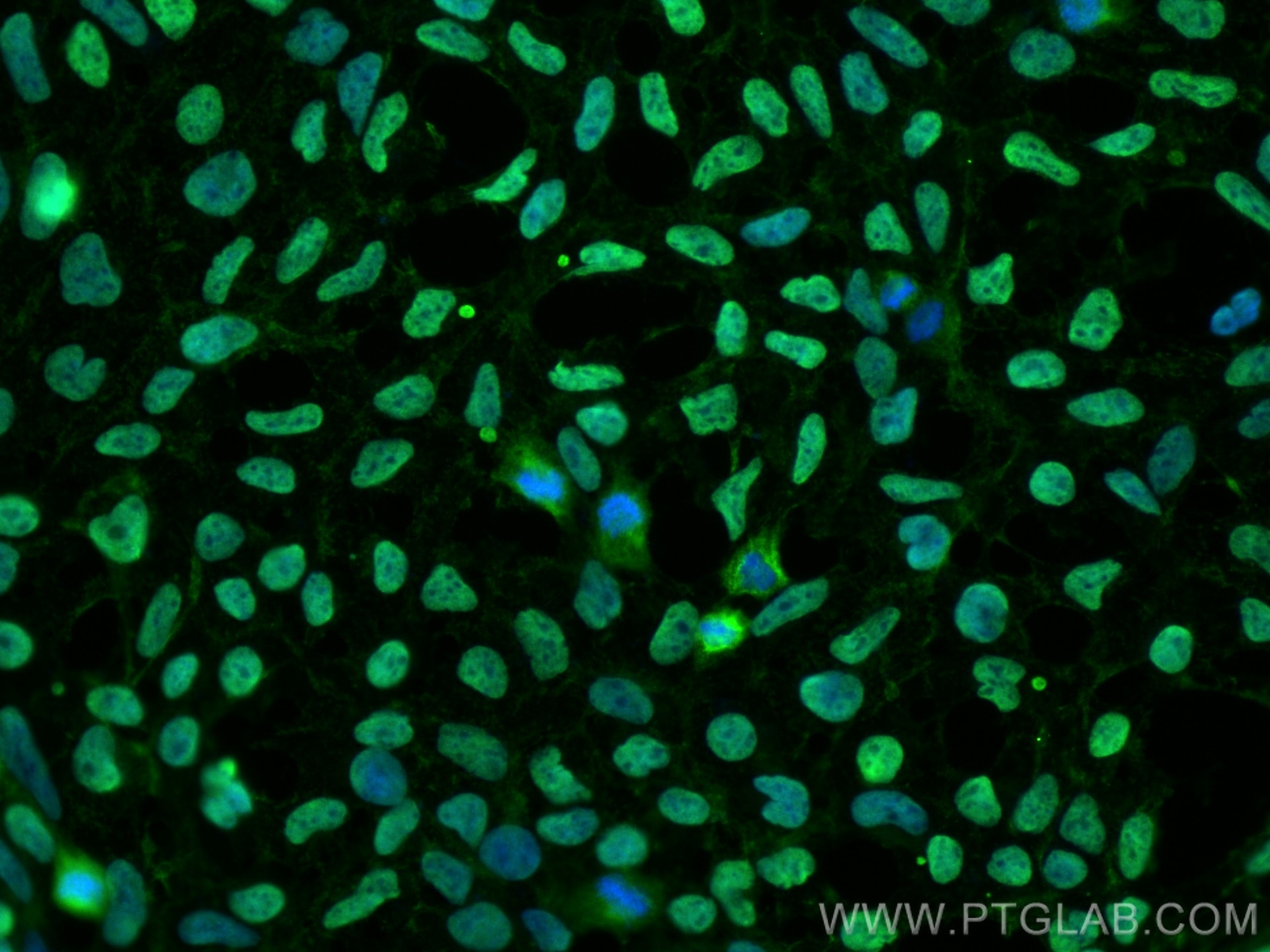 Immunofluorescence (IF) / fluorescent staining of HEK-293 cells using DACH1 Monoclonal antibody (60082-1-Ig)