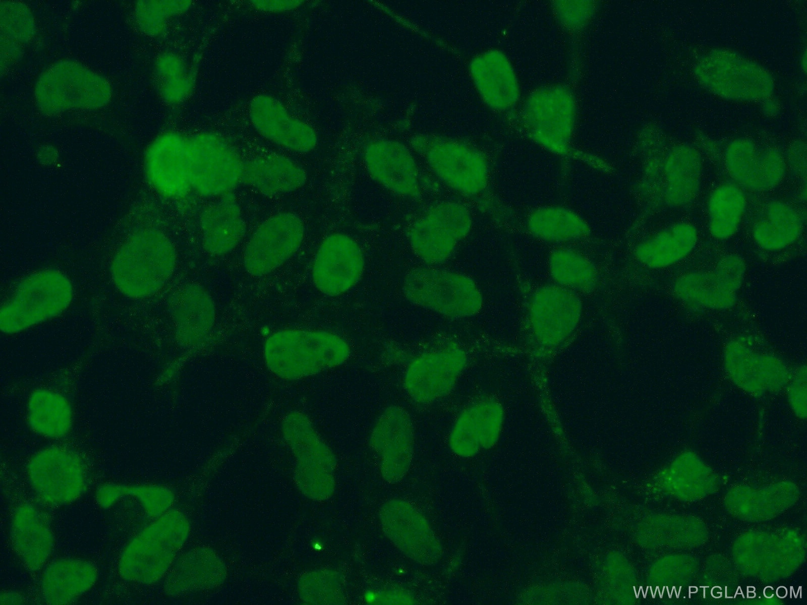 DACH1 Monoclonal antibody